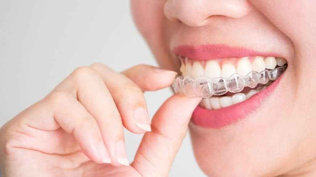 Invisalign®, Dentistry in Noblesville, IN