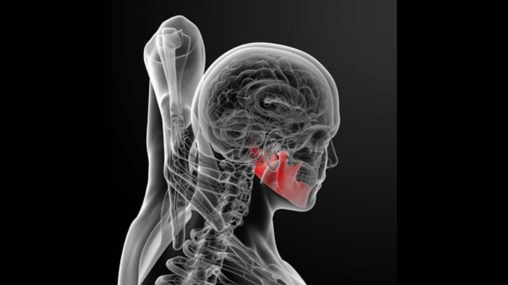jaw pain after a car accident