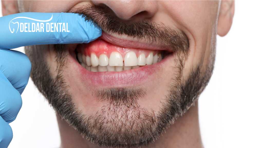 gum-disease-deldardental-noblesville