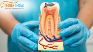 root-canal-deldardental-noblesville